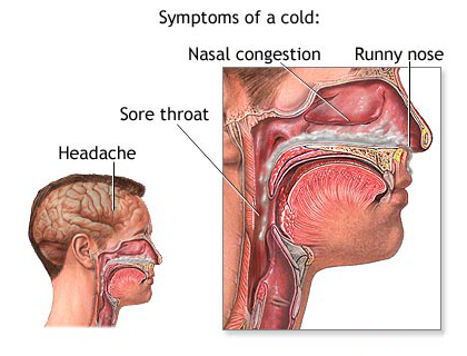 Common Cold 2 Common Cold 2